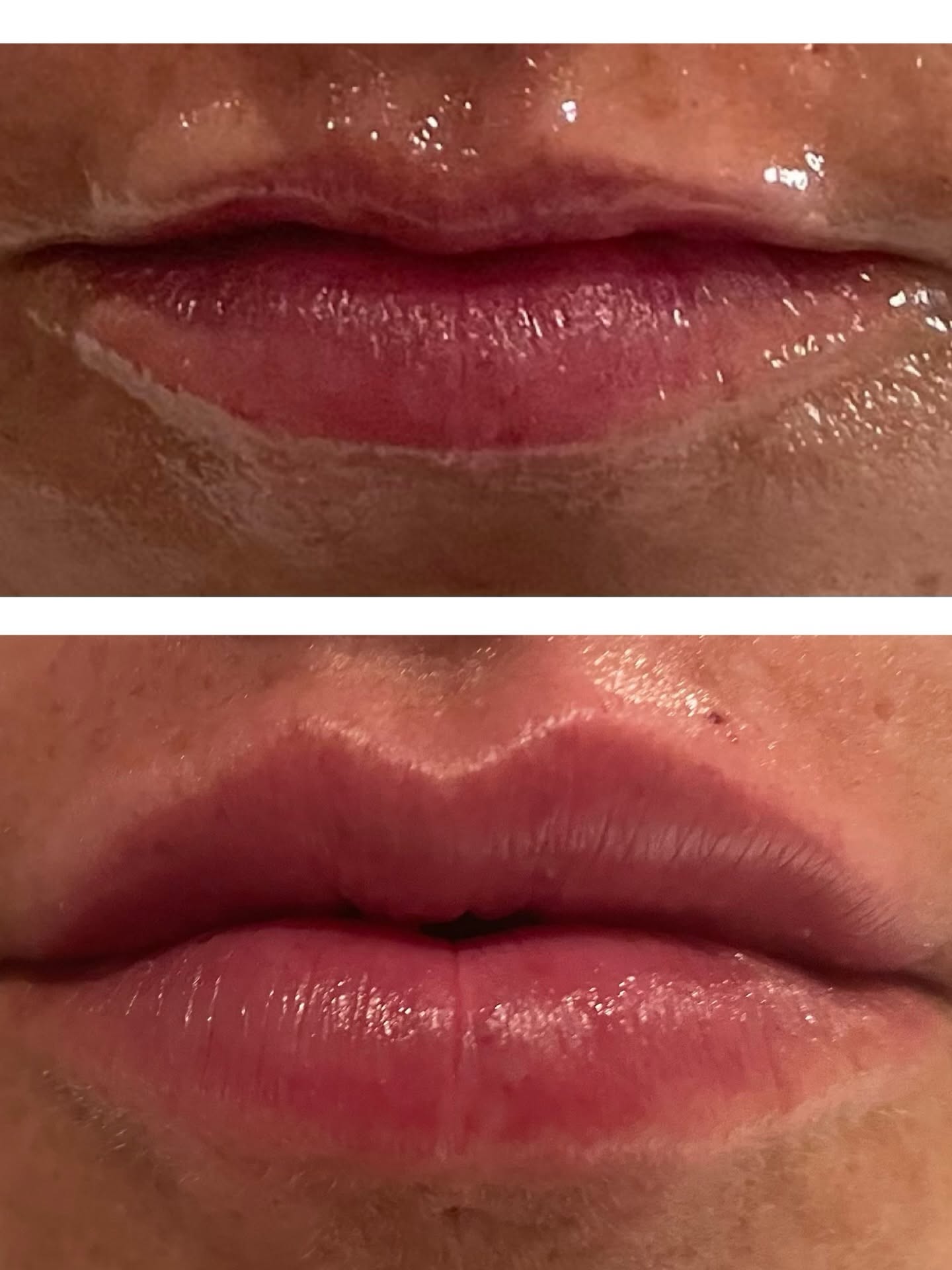 Lip Enhancement Result